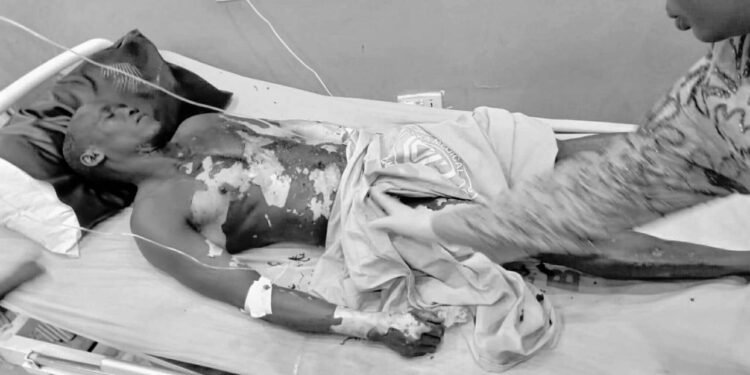 JEDCO technicians electrocuted, Company Responds to Outcry