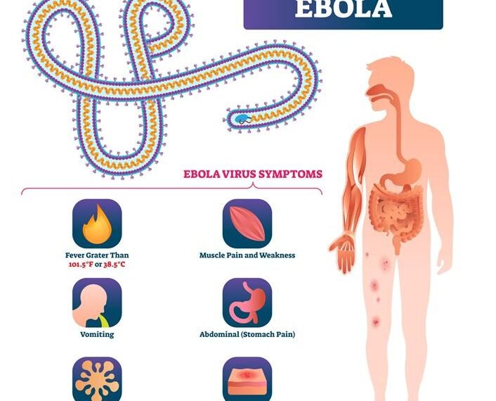 South Sudan issues alert on ebola outbreak in neighboring DRC