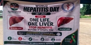 Hepatitis Screening in Azande Kingdom Finds 783 Positive Cases, Health Minister Warns of Critical Testing Gaps