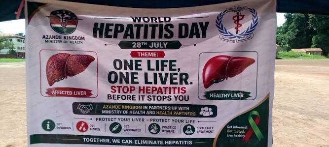 Hepatitis Screening in Azande Kingdom Finds 783 Positive Cases, Health Minister Warns of Critical Testing Gaps